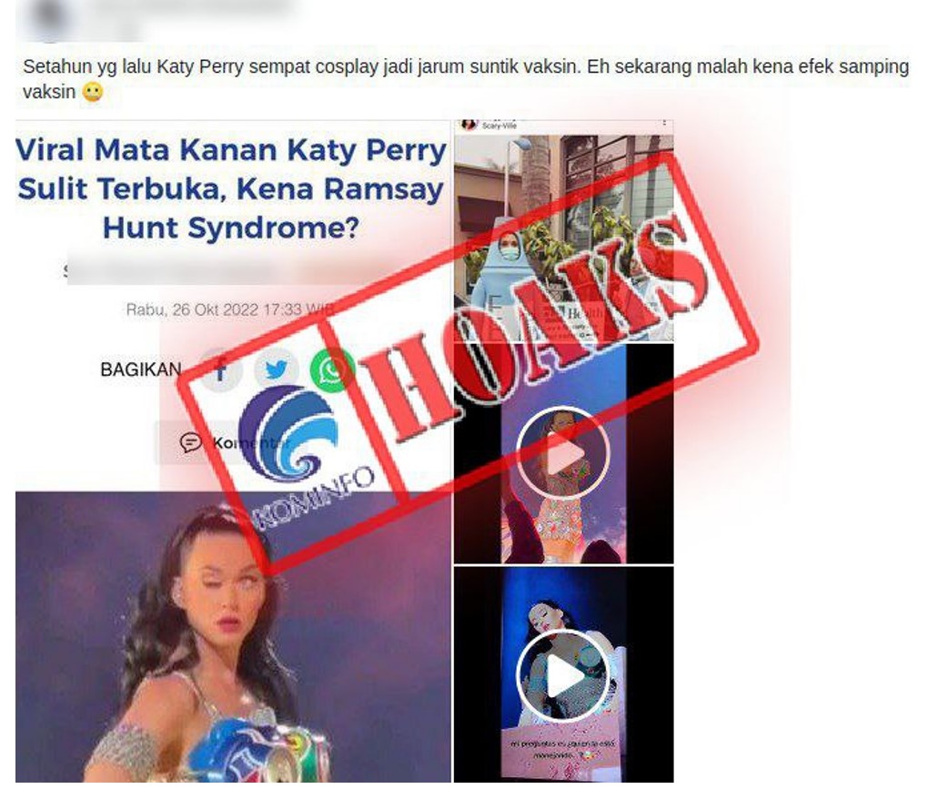 Mata Katy Perry Bermasalah Akibat Efek Samping Vaksin