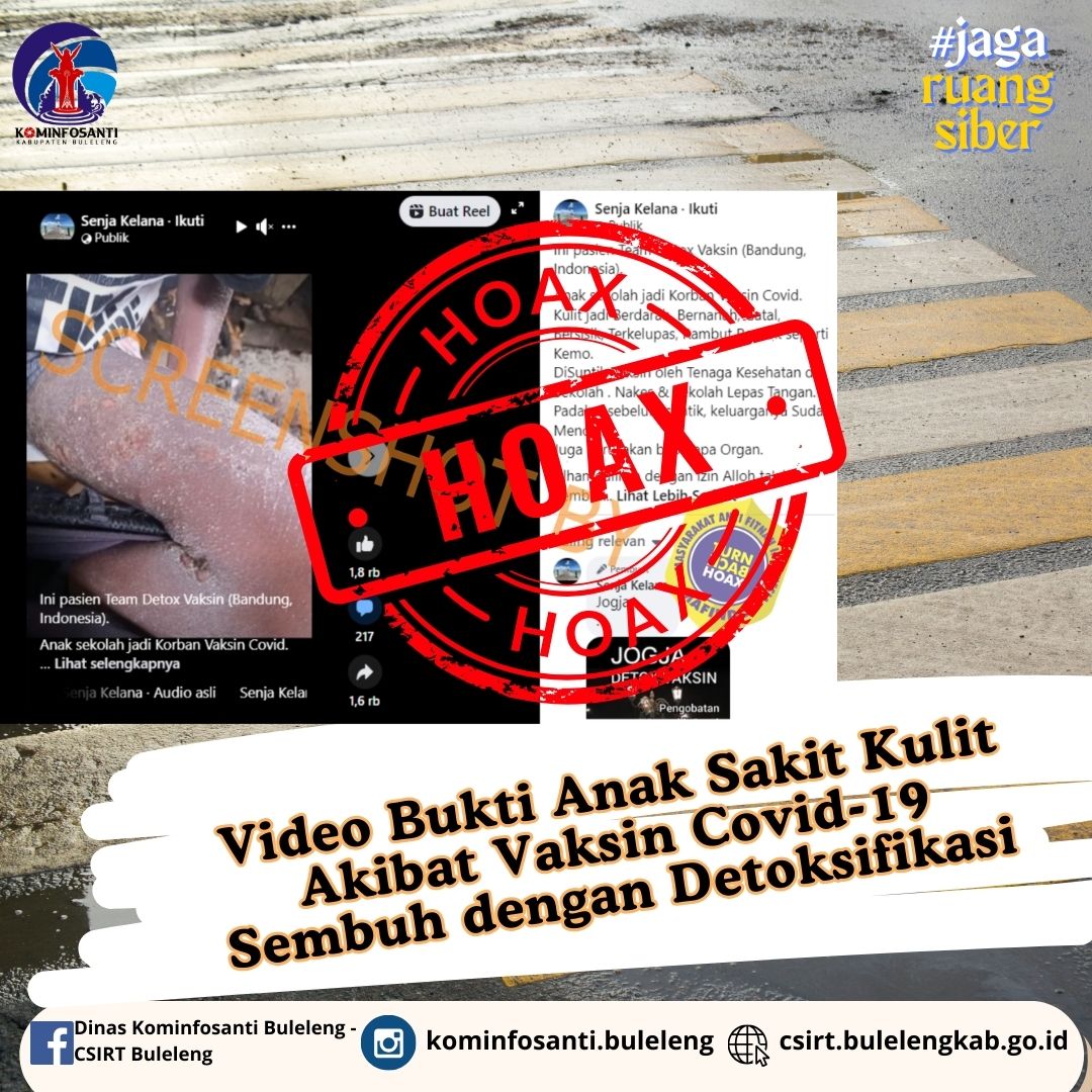 Video Bukti Anak Sakit Kulit Akibat Vaksin Covid-19 Sembuh dengan Detoksifikasi