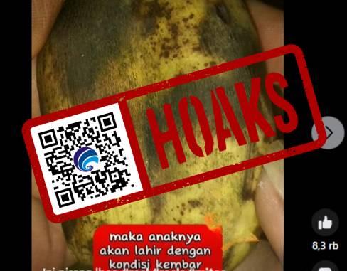 Pisang Dempet Sebabkan Anak Lahir dengan Kondisi Kembar Siam