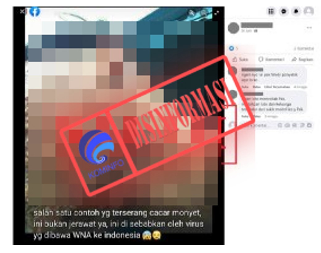 Foto Cacar Monyet Dibawa oleh WNA ke Indonesia