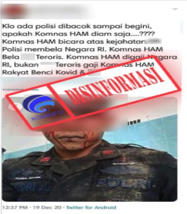 Foto Anggota Kepolisian yang Menjadi Korban Pembacokan dan Dibiarkan Komnas HAM