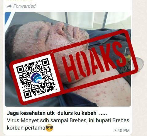 Pj Bupati Brebes Terkena Virus Cacar Monyet