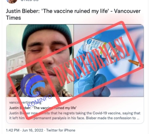 Justin Bieber Mengaitkan Kelumpuhan Wajahnya dengan Vaksin Covid-19