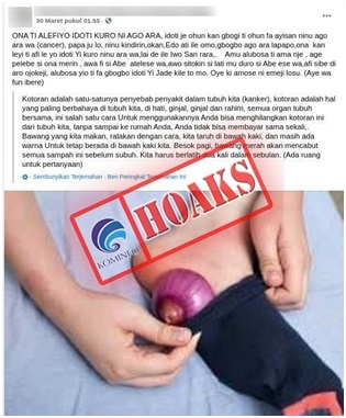 Meletakkan Bawang di Bawah Telapak Kaki Dapat Menyembuhkan Kanker dan Malaria