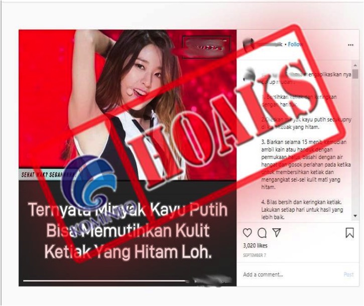 Minyak Kayu Putih Bisa Memutihkan Ketiak