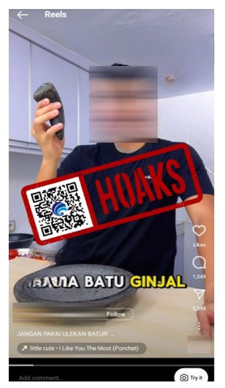 Serpihan Batu yang Berasal dari Ulekan Dapat Menyebabkan Batu Ginjal