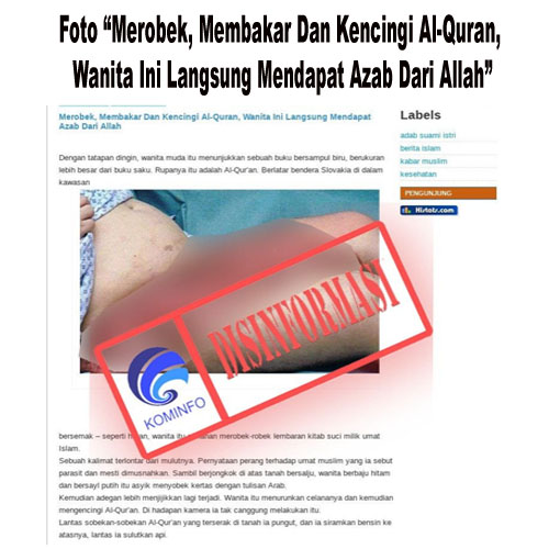 Foto “Merobek, Membakar Dan Kencingi Al-Quran, Wanita Ini Langsung Mendapat Azab Dari Allah”