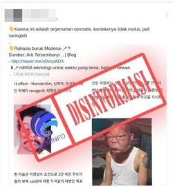 Foto Pria dengan Wajah Bengkak Akibat Efek Samping Vaksin Moderna