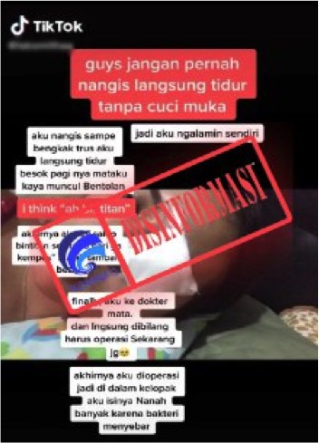 Terlalu Lama Menangis Sebabkan Bintitan pada Mata