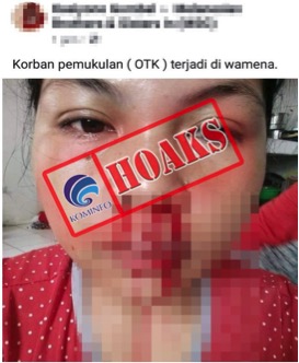 Korban Pemukulan OTK di Wamena