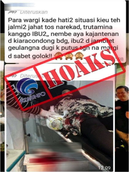 Foto Perempuan Tangannya Buntung Akibat Dijambret di Kiaracondong